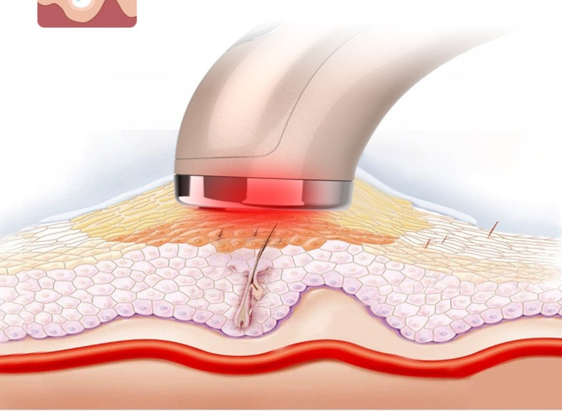 Far-Infrared Red Light Photon Skin Rejuvenation Instrument